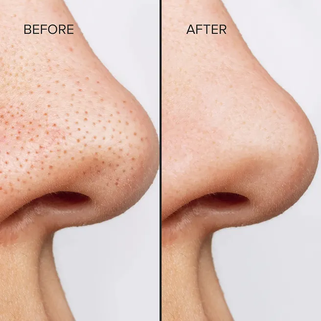 Refines Texture and Minimizes Pores