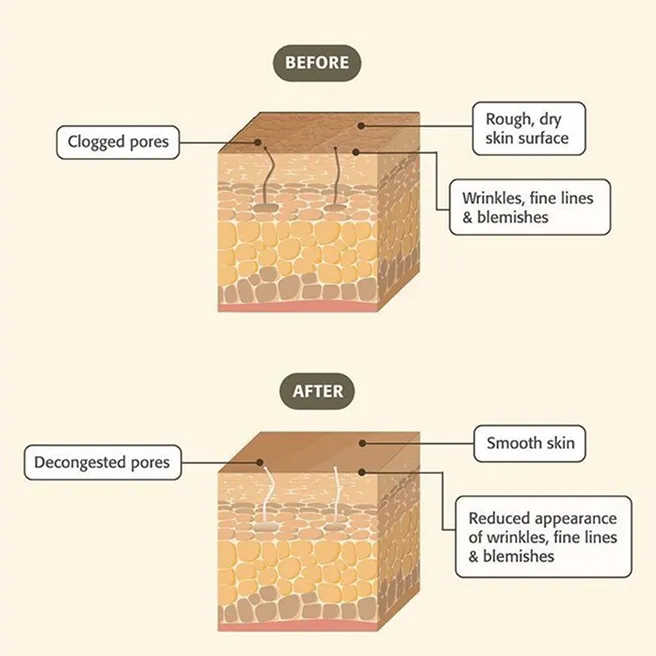 Restores Radiance and Natural Glow