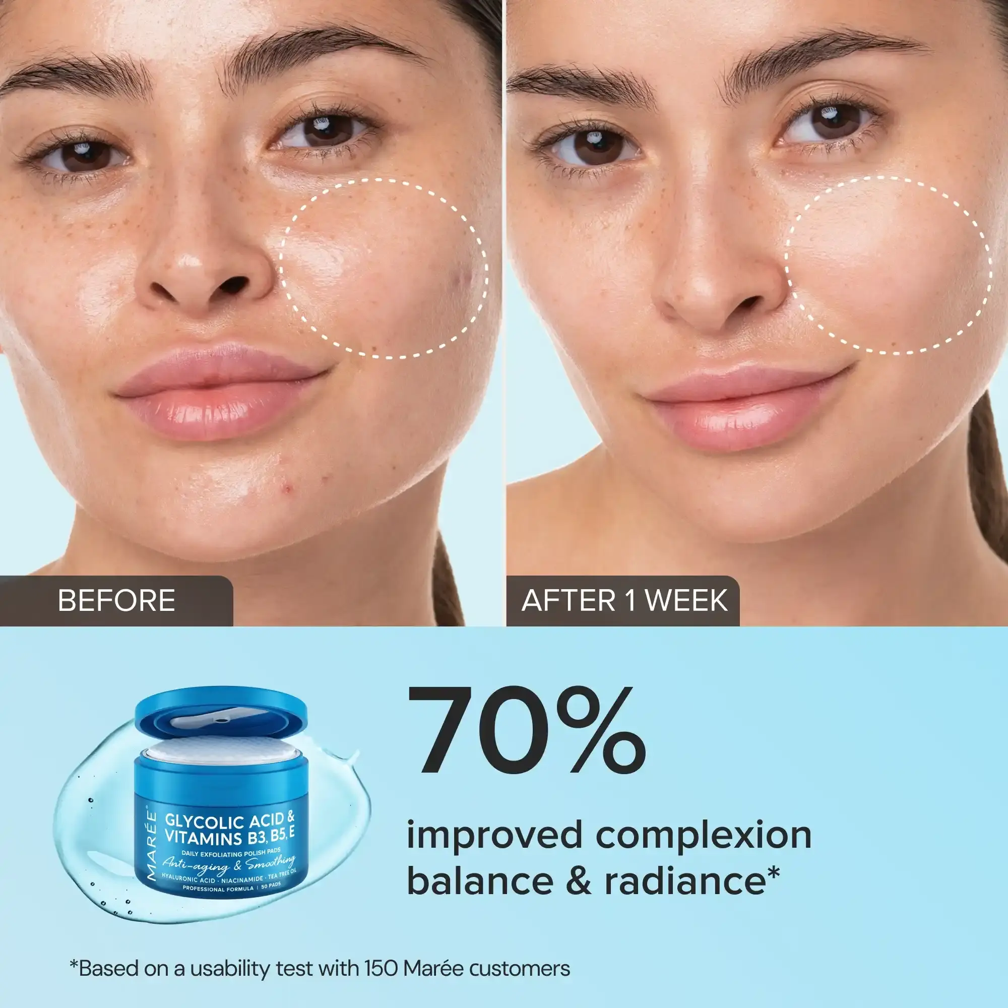 Maree Glycolic Acid Exfoliating Pads Before After