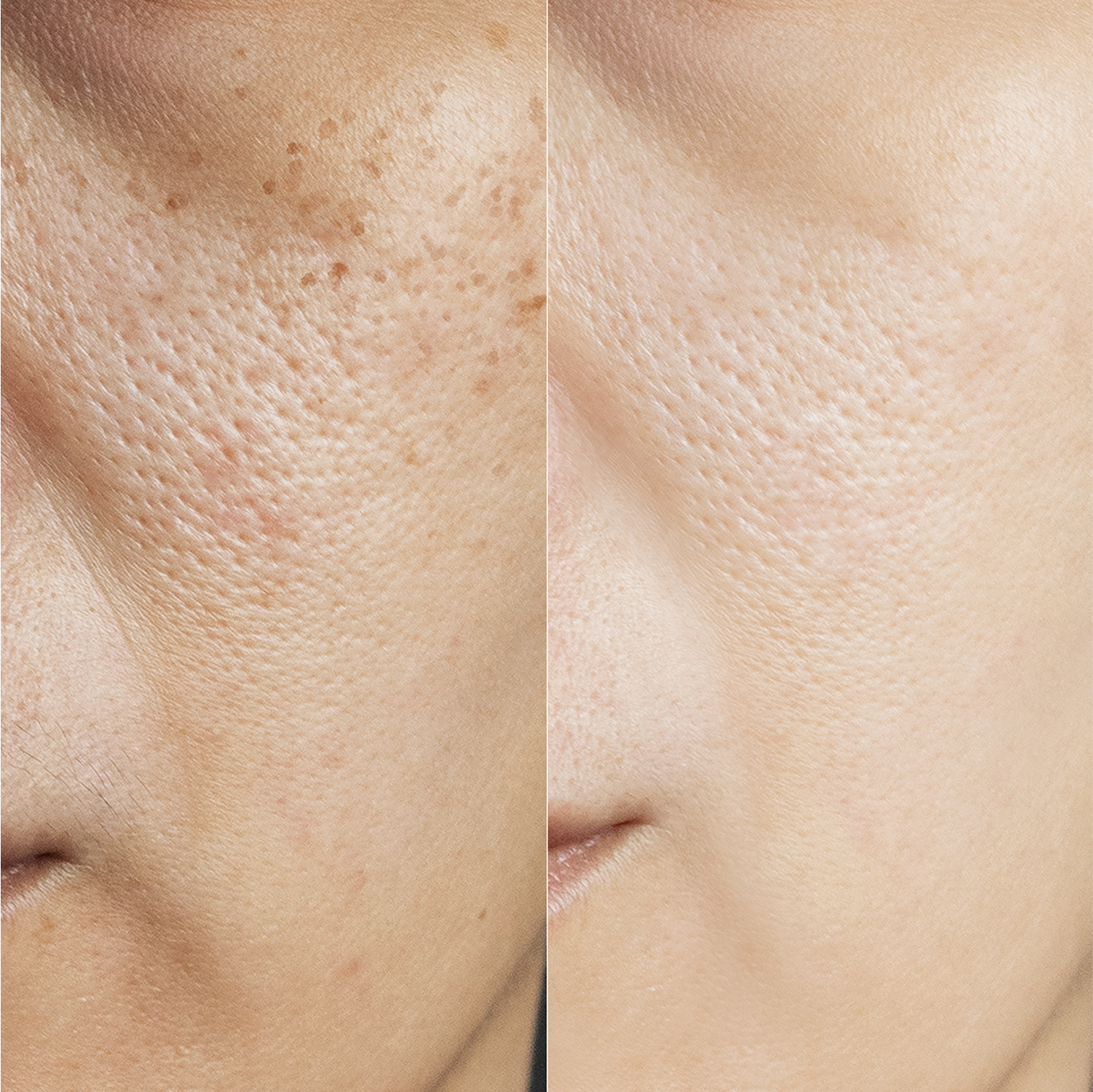 Maree Glycolic Acid Exfoliating Pads Before After Third