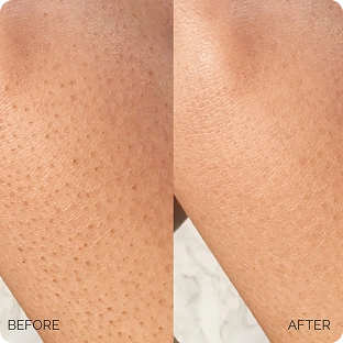 Maree Glycolic Pads before / after